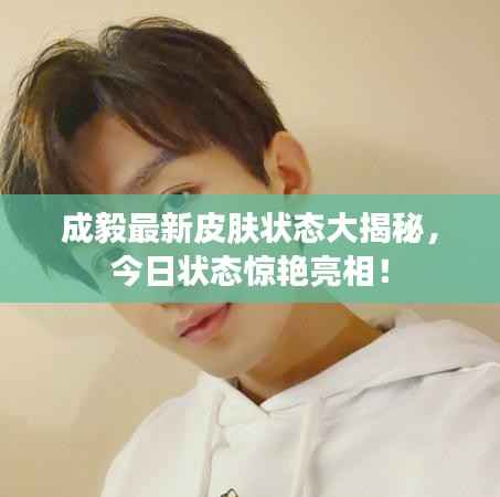 成毅最新皮肤状态大揭秘，今日状态惊艳亮相！